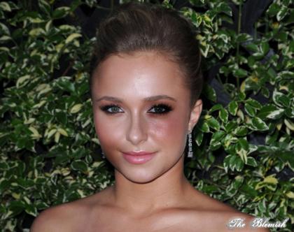 Hayden Panettiere's dad given probation