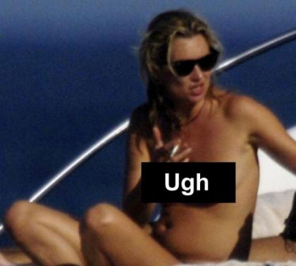 Kate Moss is topless again