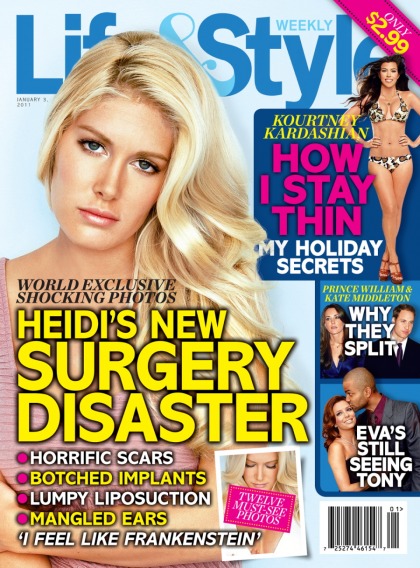 Pitiful Heidi Montag reveals her scars to Life & Style