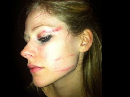 Here's Avril Lavigne's Face After Getting Beat Up