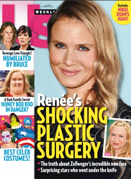Renee Zellweger 'is having a hard time accepting she's not the hot young thing'